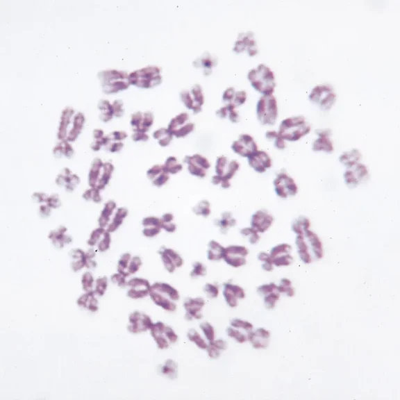 Human Male Chromosomes - 46, Xy, Spread Microscope Slide