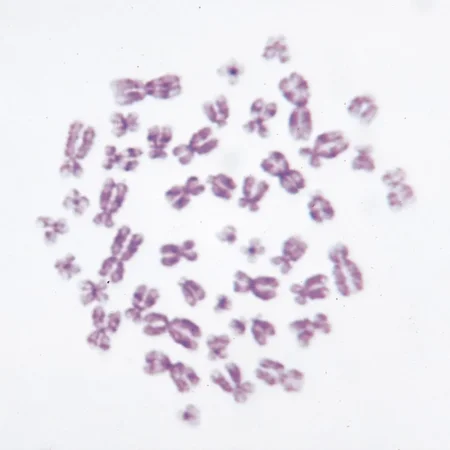 Human Male Chromosomes - 46, Xy, Spread Microscope Slide
