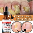 thumbnail image 4 of 2026 Nail Fungal Solution,Nail Repair for Fingernails Toenails, Toe Nail Fungal Treatment Fungal Nail Solution Fixes Nails Safe Effective(30ML), 4 of 5