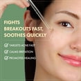thumbnail image 3 of Sérum facial TOSOWOONG Madagascar Centella 86% Ampolla 100 ml, 3 of 6