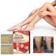 thumbnail image 1 of Varicose Care Patch Leg Massage Relieve Soreness Earthworm Leg Vein Care Patch Massage O, 1 of 4