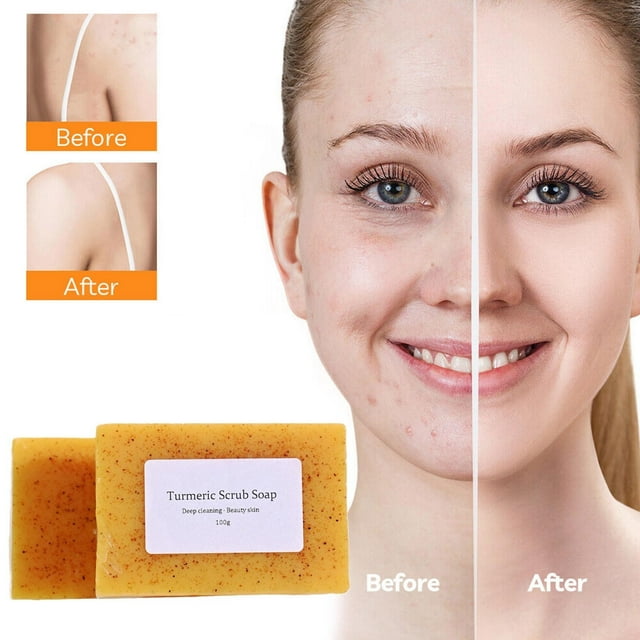 Jabón En Pastillas de Cúrcuma y Limón | Jabón Facial y Corporal Limpiador E Iluminador | Reafirma Los Poros y Elimina La Pigmentación | 1 Jabón