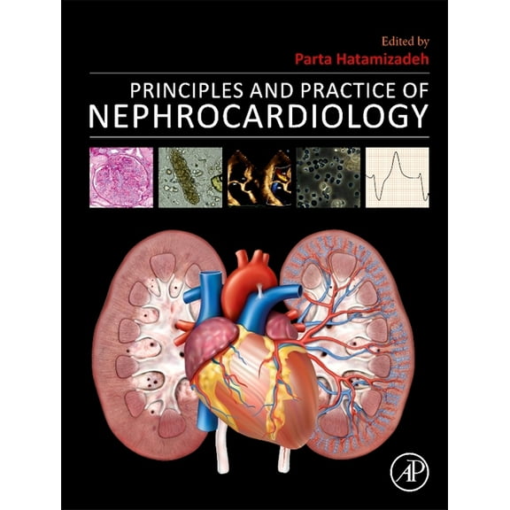 Principles and Practice of Nephrocardiology, (Hardcover)
