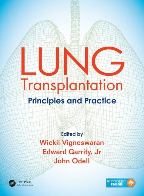 Lung Transplantation : Principles And Practice (Hardcover) - Walmart ...