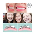 thumbnail image 5 of Dental Bracket, Brackets for Braces, 5 Sets 100 Pcs Dental Braces Teeth Model Mini 022 Slot 345 Hooks, 5 of 5