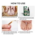 thumbnail image 4 of Nail Fungus Treatment -7 Day Nail Fungus Treatment, Nail Fungus Treatment For Toenail And Fingernail, Painless Fix And Renew Damaged,Helps Nails Healt, 4 of 5