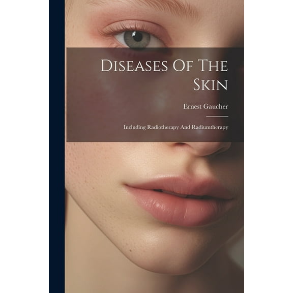 Diseases Of The Skin : Including Radiotherapy And Radiumtherapy (Paperback)