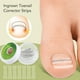 thumbnail image 3 of 10 Uds Tiras Encarnadas Para Uñas De Los Pies, Parches Correctores De Alta Elasticidad Para Evitar La Deformación, 3 of 7