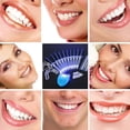 thumbnail image 1 of Dentist Teeth Whitening 44% Peroxide Dental Bleaching System Oral Gel Kit, 1 of 7