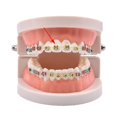 thumbnail image 4 of yingyy Orthodontics Elastic Ligature Ties Multi Color Tooth Correctors Elastic Ties, 4 of 6