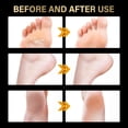 thumbnail image 4 of Fiudx Botitas Exfoliantes, Mascarilla Exfoliante para Piel Muerta, Tratamiento para Pies de Bebé, Reparación de Talones Agrietados, Cuidado de Pies Fácil de Usar, Mimos para Hombres y Mujeres, Fórmul, 4 of 6