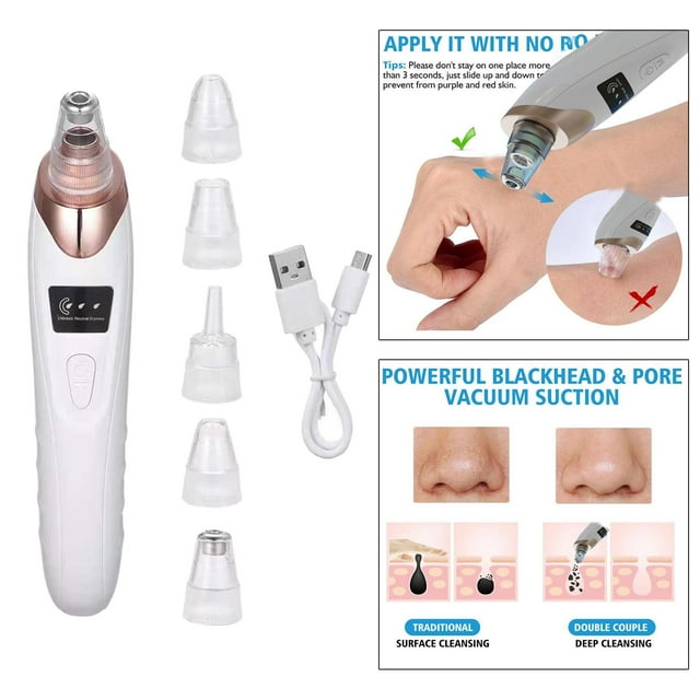 - Facial Electric Removal, Fast USB Rechargeable with 5 Replaceable Suction Head, 3 Adjustable Suction Power