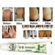 thumbnail image 2 of 5x Piel Psoriasis Crema Dermatitis Eczema Crema Eczema, 2 of 5