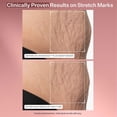 thumbnail image 4 of Crema hidratante StriVectin SD Advanced Plus para rostro y cuerpo 120 ml, 4 of 8