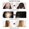 thumbnail image 3 of Suero Para El Crecimiento Del Cabello, 2 Unidades De 30 Ml, Repara Las Cutículas, El Líquido Para El Cuidado Del Cabello Mantiene La Salud Del Cuero Cabelludo Para El Cuidado Del, 3 of 7