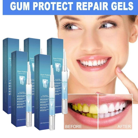 GuluguLa 5pcs Teeth Whitening Pen, Teeth Whitening Pen Gel Kit, Rotary Tooth Whitening Pen, for Stain Removal - No Sensitivity 4.0ML