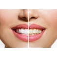 thumbnail image 3 of Clearly GLOW Activated Charcoal Powder for Teeth Whitening (20g), 3 of 3
