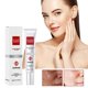thumbnail image 5 of Restaurador de manchas Yanshi crema eliminadora de manchas 20g, 5 of 6