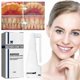 thumbnail image 1 of Suitable for Calculus Dissolving Dental Spray, 30ml Oral Tooth Cleaner Tartar Remover-jc, 1 of 4