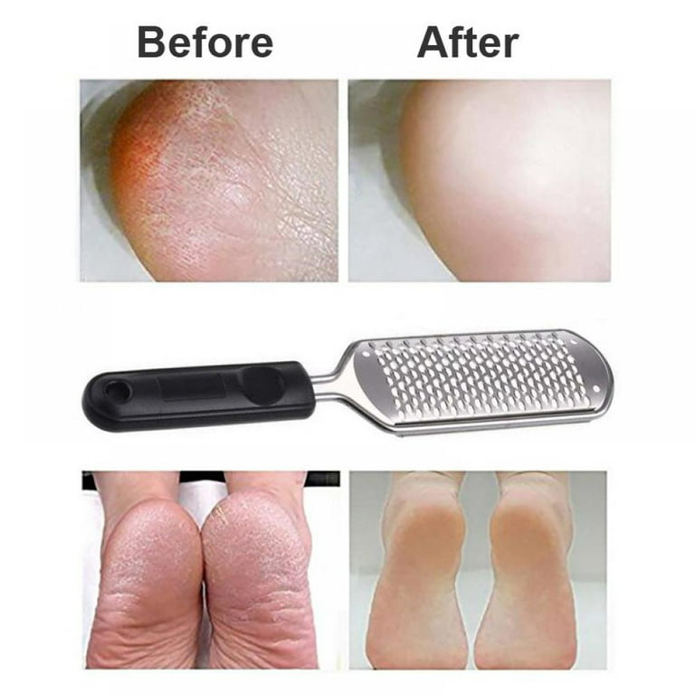 Foot Scrubber Callus Remover, Pedicure Metal Tool Heel Foot Scraper for Dead Skin, Callus, Cracked Heels, Hard Skin Remover, Size: One Size
