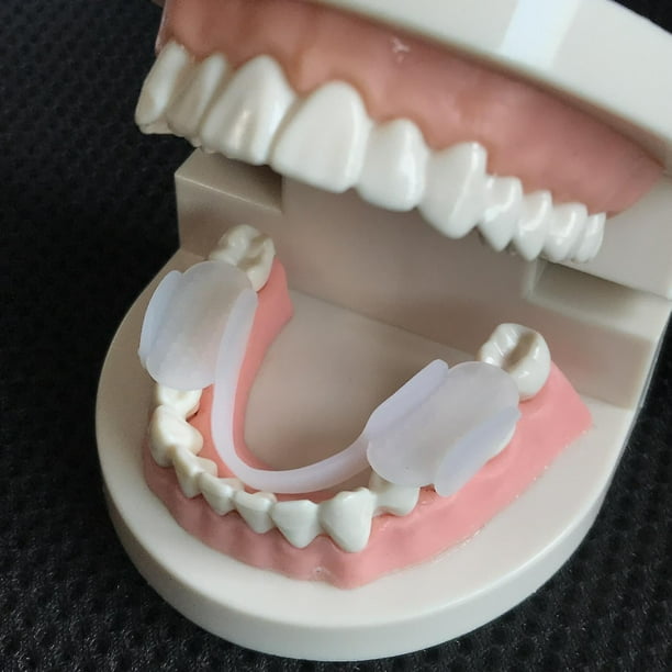 Bruxisme Protège-Dents Protège-Dents Attelle Serrement Bagues d'Alignement  Entraîneur Aide-Sommeil Outils Protecteurs des Dents 