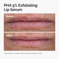 thumbnail image 2 of Sérum Exfoliante Labial PHA 5% The Ordinary 15ml, 2 of 6
