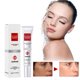 thumbnail image 4 of Restaurador de manchas Yanshi crema eliminadora de manchas 20g, 4 of 6