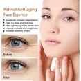 thumbnail image 4 of Sérum Visage au Rétinol 30 ml - Traitement des Rides et de l'Acné pour une Peau Éclatante - Sérum au Rétinol Haute Résistance pour le Visage, 4 of 5