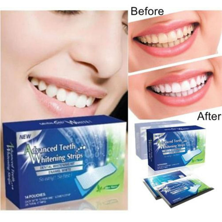 Amazon.com: Premium Teeth Whitening Strips - 28 Peroxide