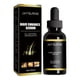 thumbnail image 2 of Fórmula de aceites esenciales, sérum para el crecimiento del cabello, aceite, ingredientes, para cabello y cuero cabelludo secos y dañados, cabello fuerte y vital 30 ml. Esencial., 2 of 9