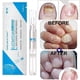 thumbnail image 3 of 3 ML Nail Repair Liquid Pen With Brush Gentle Anti Fungal Remover Onychomycosis, 3 of 4