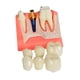 thumbnail image 2 of Modelo de implante,Modelo de implante para la educación del paciente,Presentación con puente coronal removible,Práctica de enseñanza con modelo dental 4 veces,Clase de demostración, 2 of 9