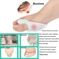 thumbnail image 6 of WILLED Bunion Cushion Protector, 4 Packs of Bunion Corrector Pads with Separator for Big Toe, Gel Shield for Foot Pain Relief, Calluses, Corns, 6 of 7