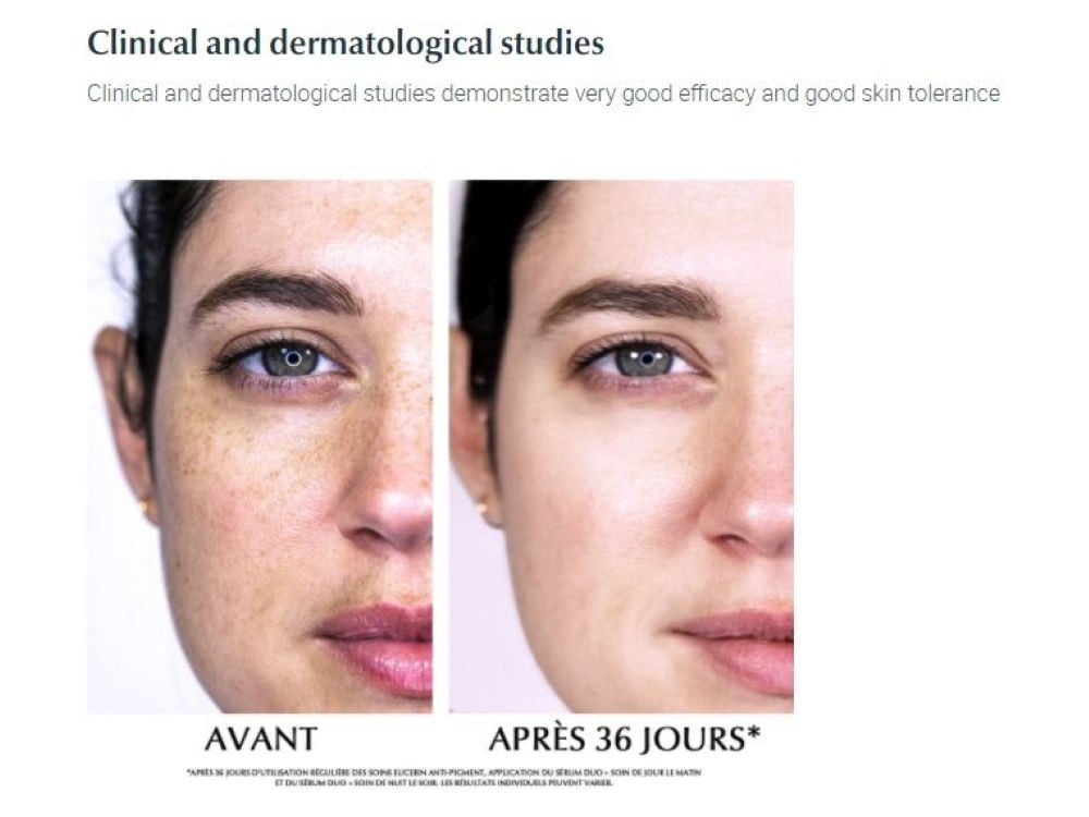 Eucerin Anti-Pigment Day Care SPF30 50ml Reduces and Prevents Pigment Spots on the Skin.