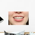 thumbnail image 1 of Girl Smiles with Braces Wall Mural by Wallmonkeys Peel and Stick Graphic (18 in W x 12 in H) WM125249, 1 of 4