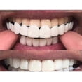 thumbnail image 3 of Upper/lower Comfort Fit Flex Whitening Denture Braces, 3 of 5