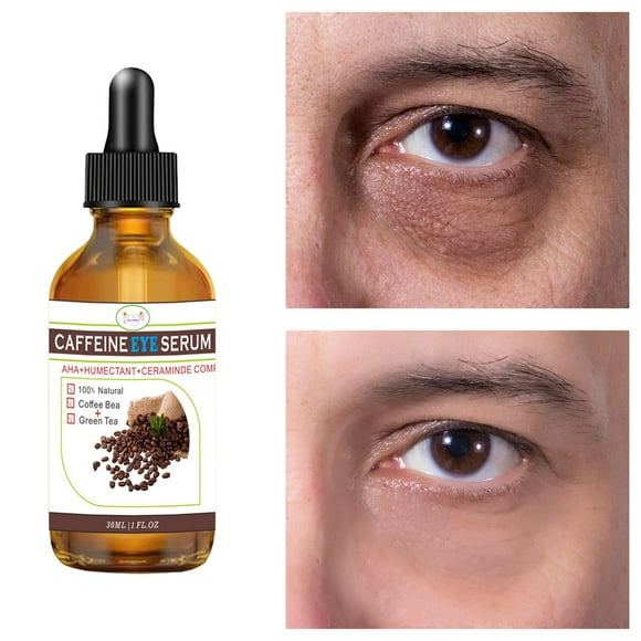 Suero de para ojos, aceite esencial hidratante para ojos para hinchazón de ojos, bolsas para ojos, líneas finas alrededor de los ojos PC 1 Macarena suero de ojos