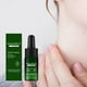 thumbnail image 3 of Corrector de manchas Essence Advanced Oil 3 Bio, reduce las manchas oscuras y estimula el enrojecimiento, 20 ml, cuidado de la piel, 3 of 9