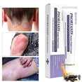 thumbnail image 1 of Crema Herbal para el Alivio Crema Herbal para el Alivio de la Psoriasis kaili Sencillez, 1 of 3