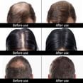 thumbnail image 4 of Solución Para la Caída del Cabello ANGGREK Fibra Capilar Más Densa 50 g, 4 of 8