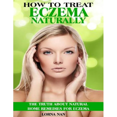 How to Treat Eczema Naturally: The Truth About Natural Home Remedies for Eczema - (The Best Way To Treat Eczema)