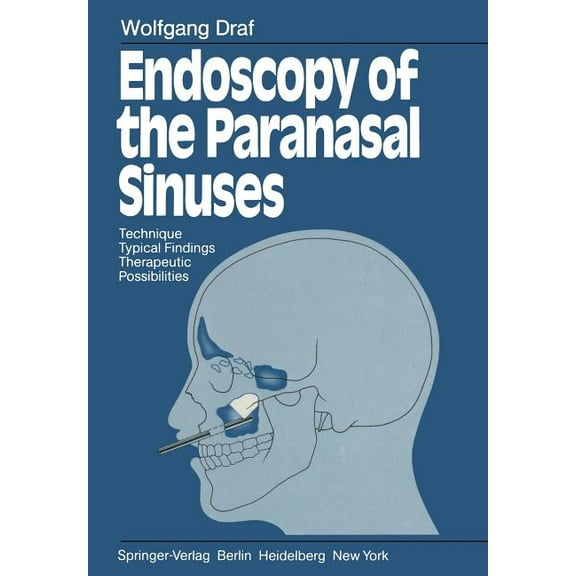 Endoscopy of the Paranasal Sinuses: Technique - Typical Findings Therapeutic Possibilities, (Paperback)