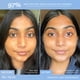 thumbnail image 3 of JAPONESQUE Maquinillas de afeitar faciales Dermaplaner plegables - Juego de 3 piezas de maquinilla de afeitar para cejas y vello facial - Maquinilla de afeitar Dermaplane fija de una hoja para mujeres, 3 of 5