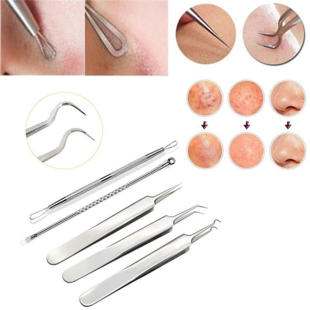 5Pcs Stainless Facial Acne Spot Pimple Remover Extractor Tool Comedone