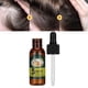 thumbnail image 4 of Suero Para El Cabello, Fortalece Las Raíces Del Cabello, Repara El Folículo Piloso, Aceite Para El Crecimiento Del Cabello, Cabello Brillante, Nutre El Cuero Cabelludo Para La, 4 of 7