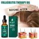 thumbnail image 4 of Aceite esencial para el cuidado del cabello y el cuero cabelludo Aceite esencial para el cuidado del cabello denso y sólido Limpieza profunda del cuero cabelludo Reparación de la raíz del cabello Ant, 4 of 5