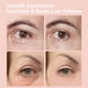 thumbnail image 5 of Parches para ojos NOVALIFT Kunnozz Micro, parches para la hinchazón y ojeras, parches para la línea de la sonrisa, mascarillas hidratantes antiarrugas para la frente para mujeres, 2 cajas (3 pares cad, 5 of 7
