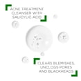 thumbnail image 3 of Paquete de cuidado de la piel VICHY Normaderm Daily Acne Face Wash + Hidratante, 3 of 9