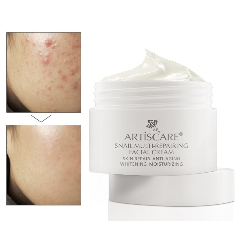 Pure Natural Snail Repair Facial Cream OilControl AntiWrinkle Acne