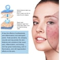 thumbnail image 3 of Kit de Microinfusión para Rostro y Labios con Suero Facial para una Piel Suave, 3 of 9